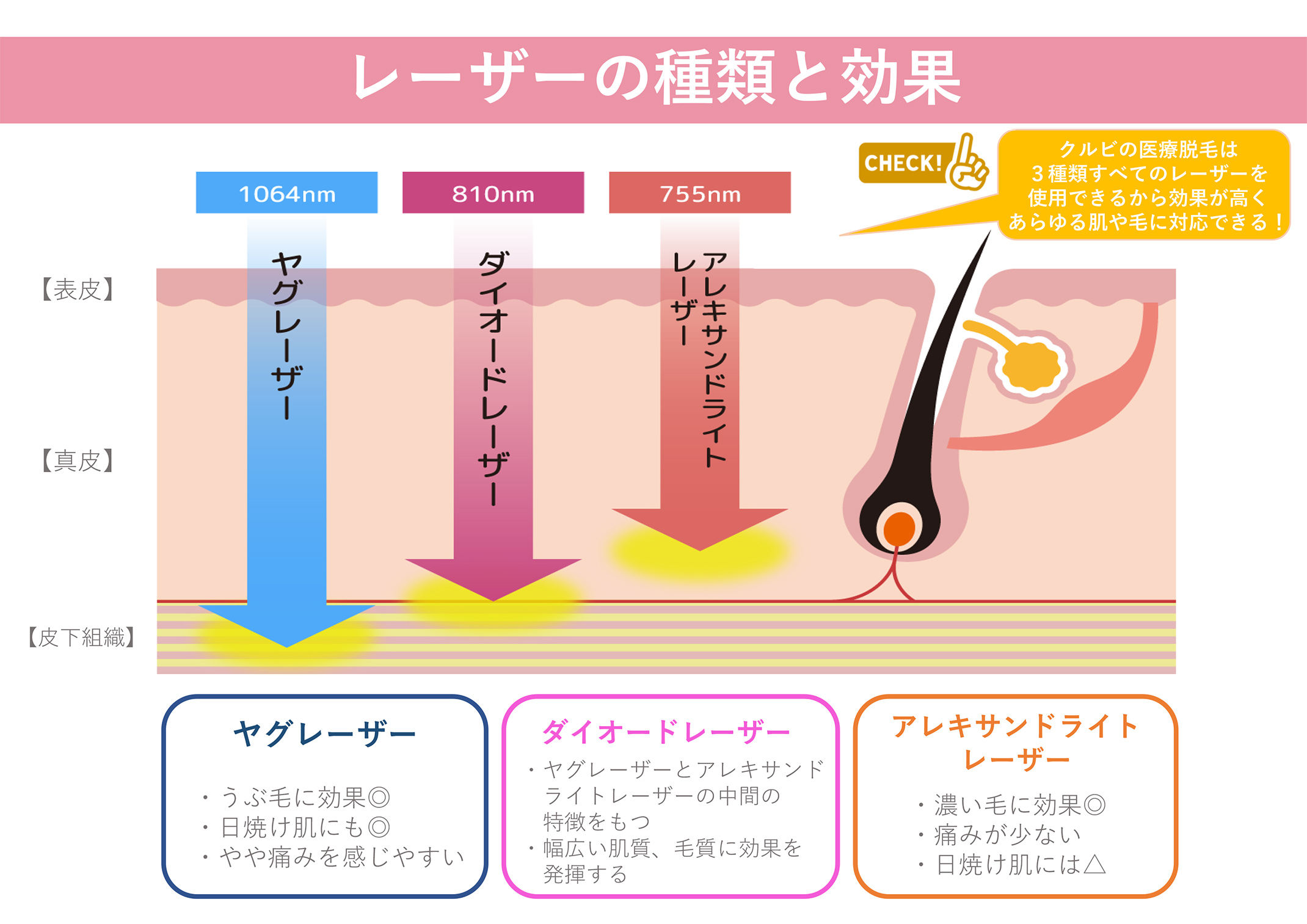 レーザーの種類と効果